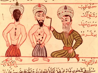 Ms Sup Turc 693 fol.35 Operation zur Kauterisation, 1466